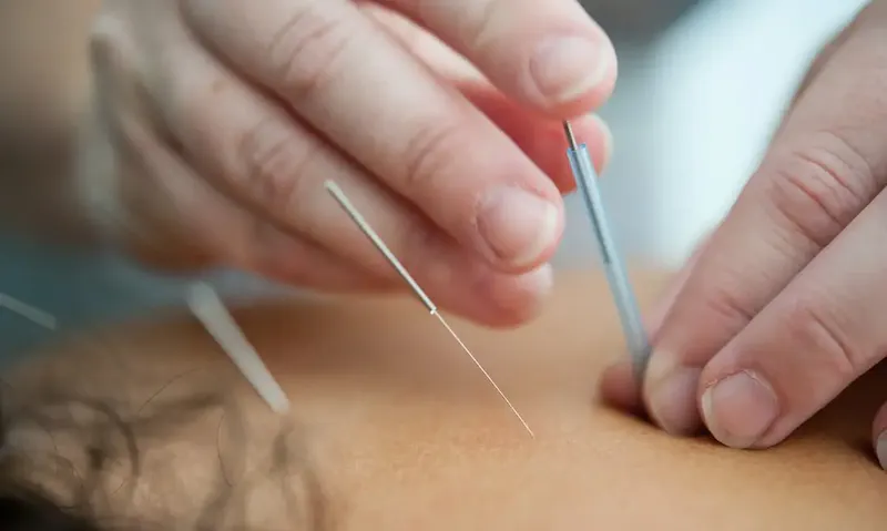 Photo de Acupuncture Traditionnelle person holding silver and white pen | Photo de Katherine Hanlon, sur https://unsplash.com/@tinymountain?utm_source=centralapp&utm_medium=referral