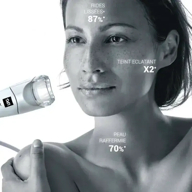 MOBILIFT Visage - LPG ALLIANCE Visage