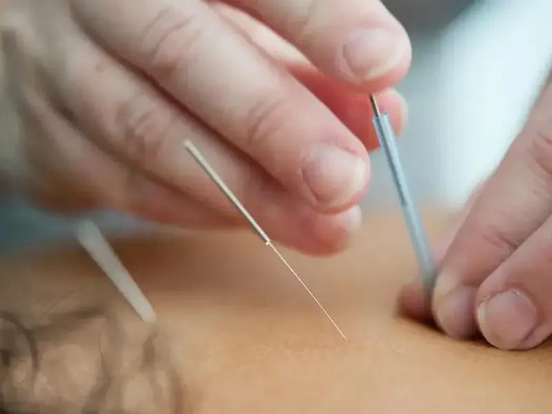 Qu’est ce que la Médecine Chinoise Classique?